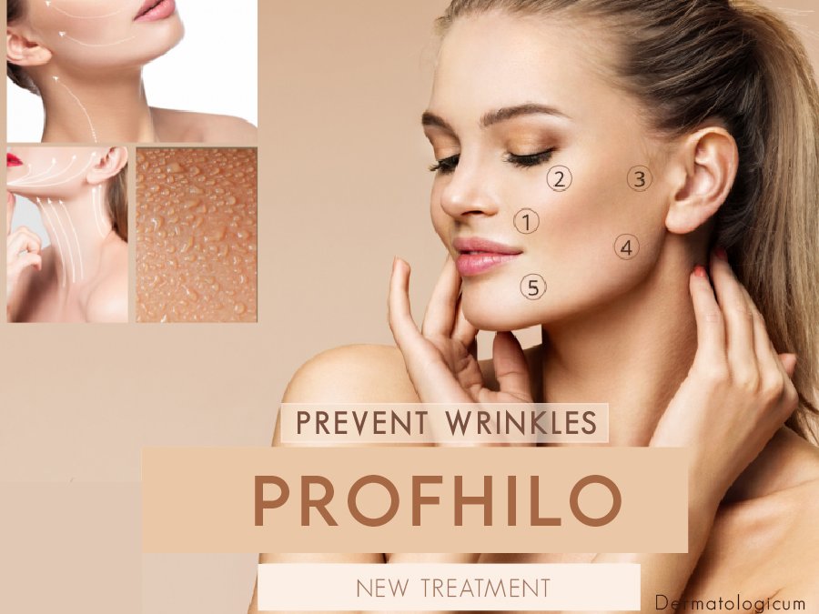 PROFHILO SKIN REMODELING TREATMENT
